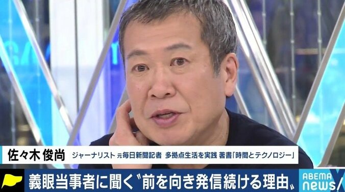 「義眼で人生が変わった」「片目が見えるじゃないかと言われ、障害者として認めてもらえない」…当事者たちに聞いた「片目失明」のリアル 14枚目