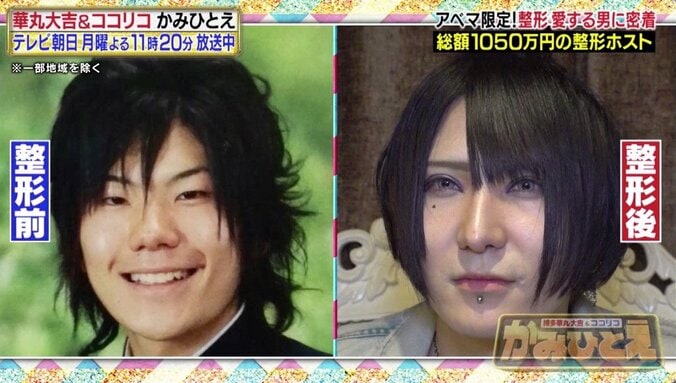 「しんどいくらい好き」美容整形に1050万円かけたホスト、常連客から愛される理由とは？ 1枚目