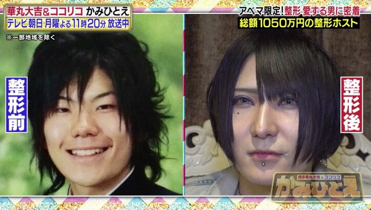 「しんどいくらい好き」美容整形に1050万円かけたホスト、常連客から愛される理由とは？