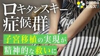 「子宮移植認めて」当事者訴えも 残る課題