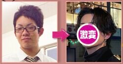 大学時代に彼女に浮気され…整形総額500万円で亀梨和也似に激変したイケメン、ビフォーアフターに驚きの声「全然違う！」「いわゆる整形顔じゃない！」
