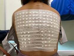  あいのり・クロ、自身の顔や脚に出ていたとても辛い症状「頑張って」「良くなる事を祈ります」の声 