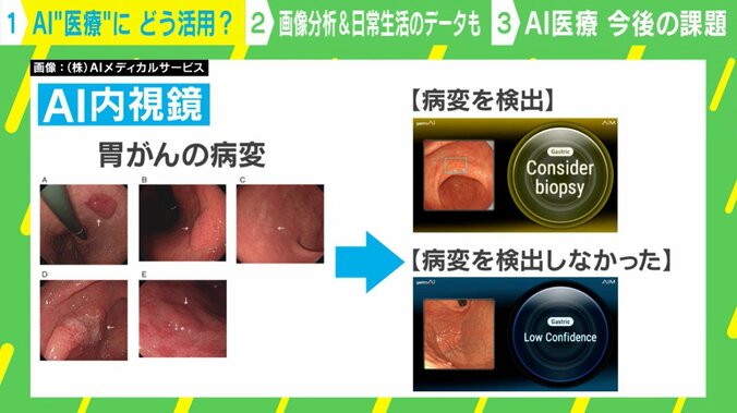 AI×医療 具体的な使われ方