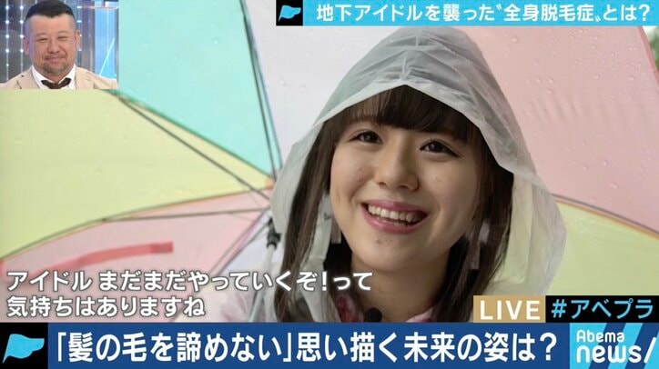 「頭が丸くても続けたい」…全身脱毛症アイドル、告白の裏にファンの後押しも