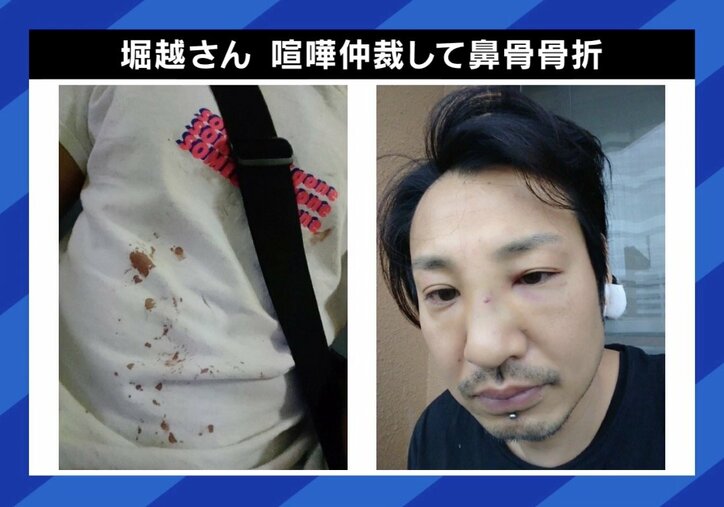 【写真・画像】街中の喧嘩止めるべき？「1人では絶対に無理」 プロに聞く対処法　3枚目