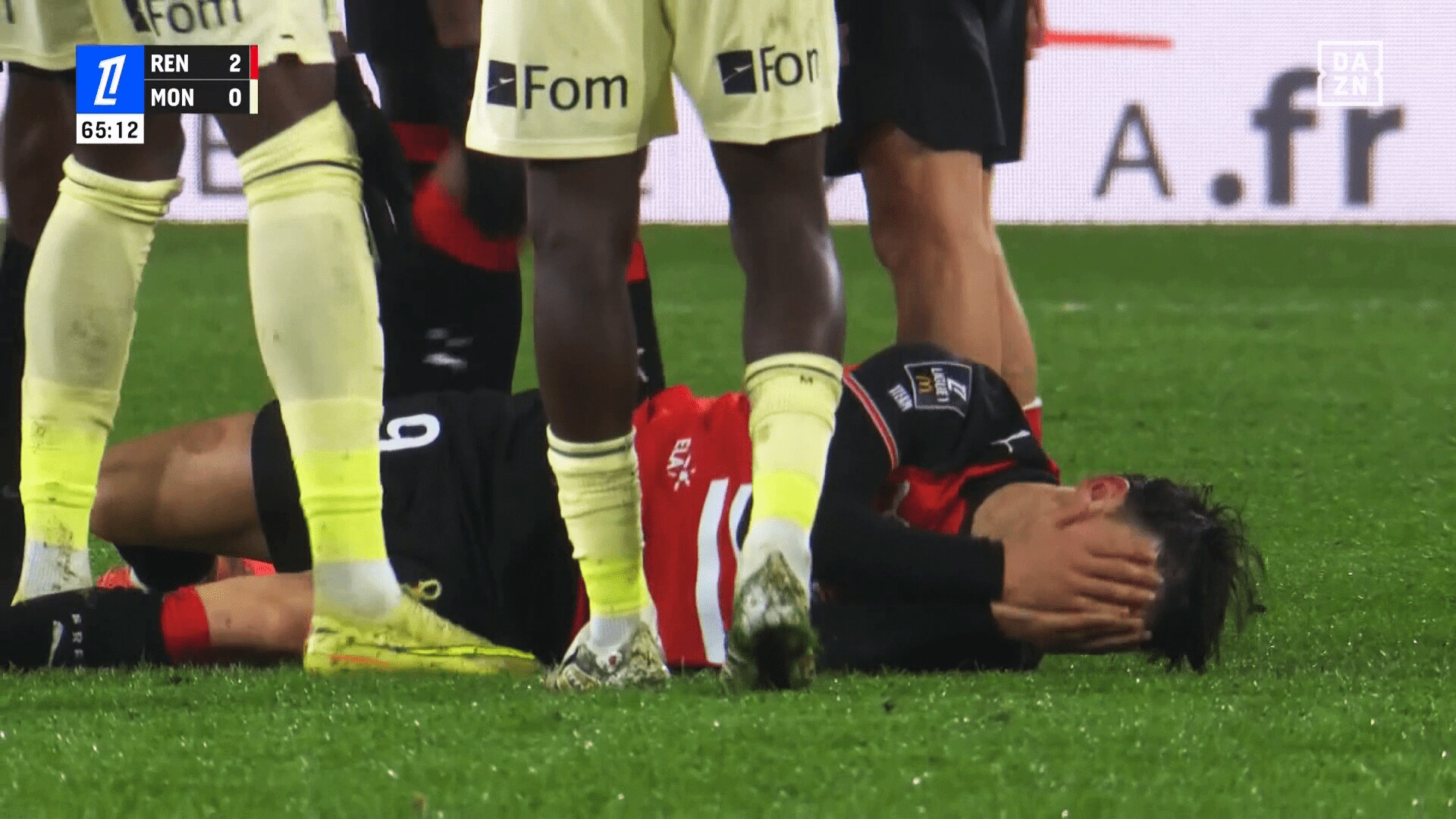 顔を抑えて痛がるルポール