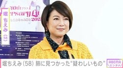 2024年に舌がん完治・堀ちえみ（58）、肺に見つかった“疑わしいもの”を公表「みんな肺のがんで亡くしているから」