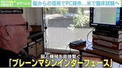 脳の信号でPC操作 米の臨床実験に専門家「ゼロが1になる」「ALS患者にとって大きな一歩だ」