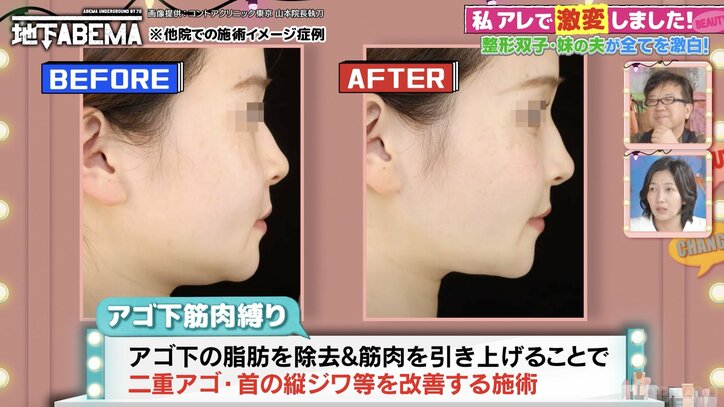 【写真・画像】「双子の娘が共に整形」実母が本音を告白「最初は大反対」「元々私に似て可愛かったのに…」　2枚目