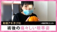 和田アキ子 術後の痛々しい眼帯姿