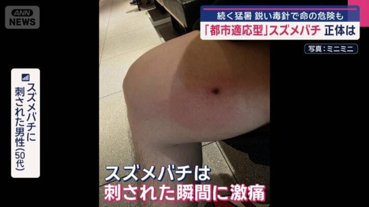 スズメバチに太ももを刺された