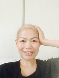 だいたひかる『変なハゲ方をしていた5年前』