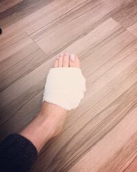 川田裕美『足の炎症』