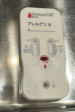  あぢゃ、長男の様子が気になり眼科で検査を受けた結果「血をとって30分くらい待ったら」 