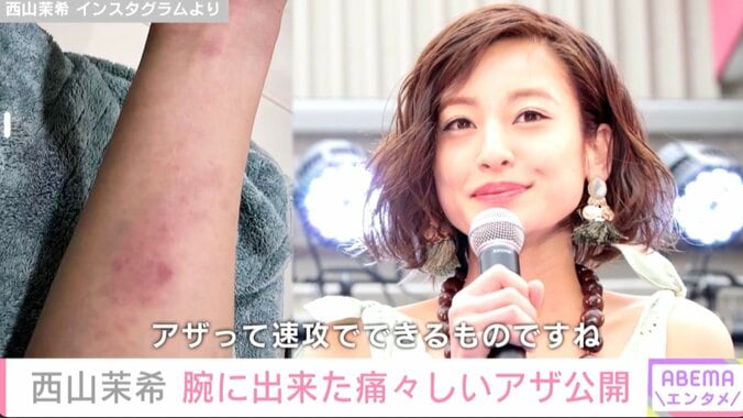 西山茉希、“ママさんバレー”で腕がアザだらけに 中学時代に全国大会出場「絶対戻りたく無いけど、絶対的に乗り越えてよかった5年間」 1枚目