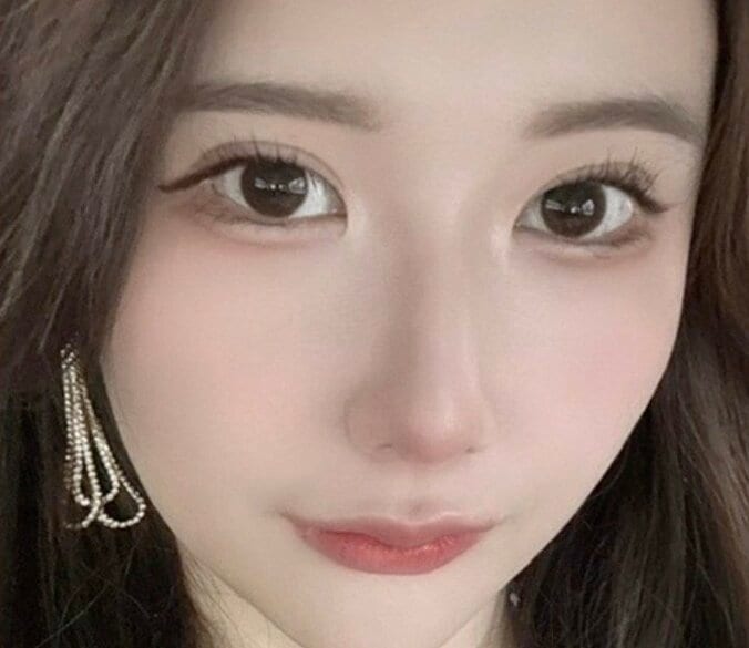 【写真・画像】整形総額1300万円の美女、“整形で縦長にした”パーツに驚きの声「なんで！？」　1枚目