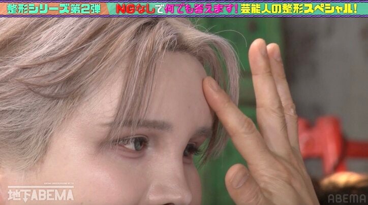 【写真・画像】Matt、美容整形のビフォーアフターを披露「昔は家に帰るとパパが腰抜かしてた」　2枚目