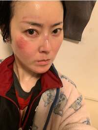 遠野なぎこ『『傷だらけのなぎこ』』