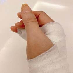  小柳ルミ子、パンパンになっていた自身の指「どうしましょう」 