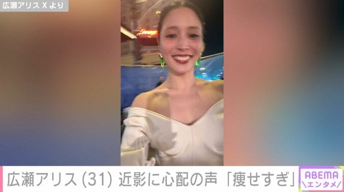 広瀬アリス