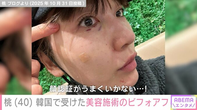 ダウンタイムの様子