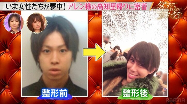 【写真・画像】整形総額1億円・アレン様、整形を始めた理由を告白　2枚目