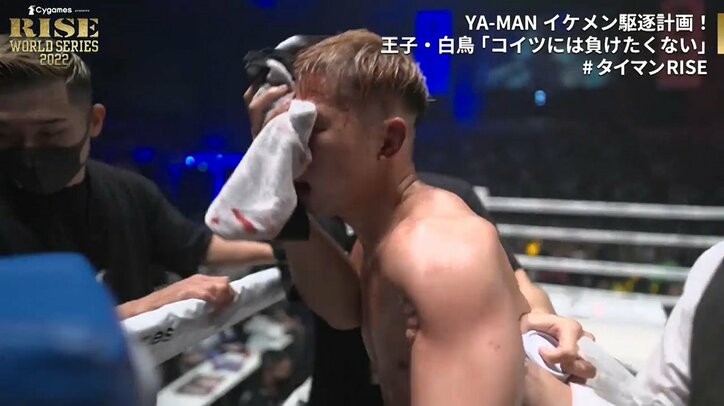救急搬送のYA-MAN「明日にでも試合できる(笑)」「アバラの軟骨が損傷。鼻が折れていたぐらいで大丈夫」と一夜明け会見でも“YA-MAN節”炸裂