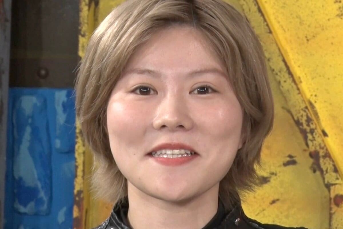 芸能人 整形 失敗
