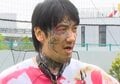 「指がない」瓜田純士の手に芸人ら驚愕「力入らない」「ビックリしたわ」