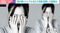 「やらなきゃよかったと…」“クマ取り”施術を受けた20代女性→片目失明の事例も 美容整形の“リスク判断”の難しさ 「合併症を正確に把握するシステムがない」医師が指摘