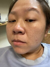 やしろ優『シミやふきでもの。』