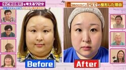 3時のヒロイン・かなで、整形ビフォーアフターを公開「そのクリニック、バズる！」整形総額6000万円・福岡みなみも絶賛