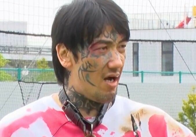 【写真・画像】「指がない」瓜田純士の手に芸人ら驚愕「力入らない」「ビックリしたわ」　1枚目