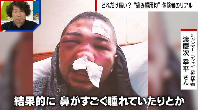 ラウェイ元世界王者の渡慶次幸平氏