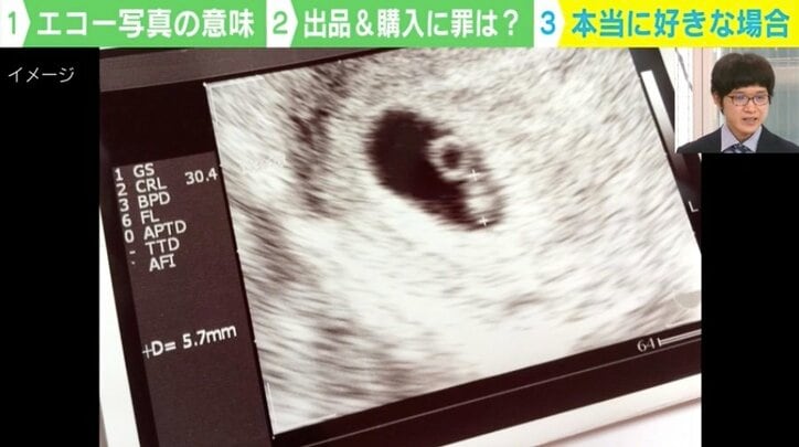 「すんげぇの売られてた」 女性が妊娠時に撮影する胎児のエコー写真がフリマサイトに出品 一体、誰がなんのために使うのか？