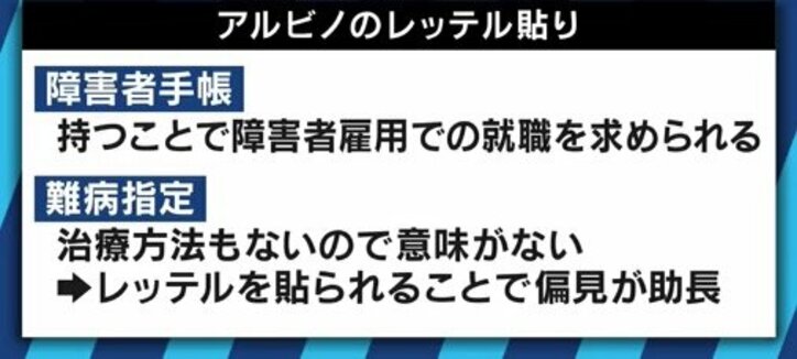生まれつき色素が薄いアルビノ当事者の苦しみ「カラーコードに合わないから‥」バイト・就職を断られるケースも