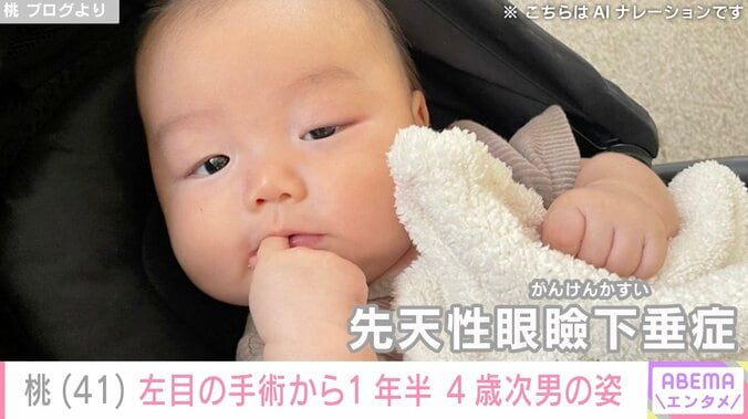 桃（41）、左目の先天性眼瞼下垂症の手術から1年半が経過した4歳次男の姿を公開 3枚目