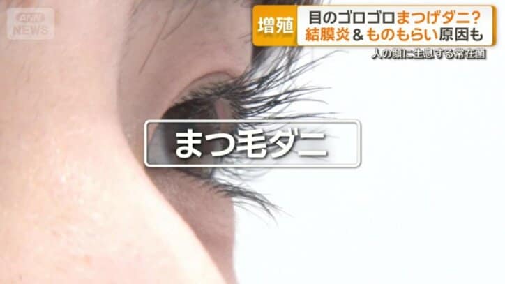 つい放置しがちな目のトラブルと関係？