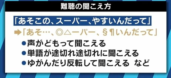 多様化する補聴器、イヤホンと誤認し「外せ」と注意も…難聴当事者の思いは 5枚目