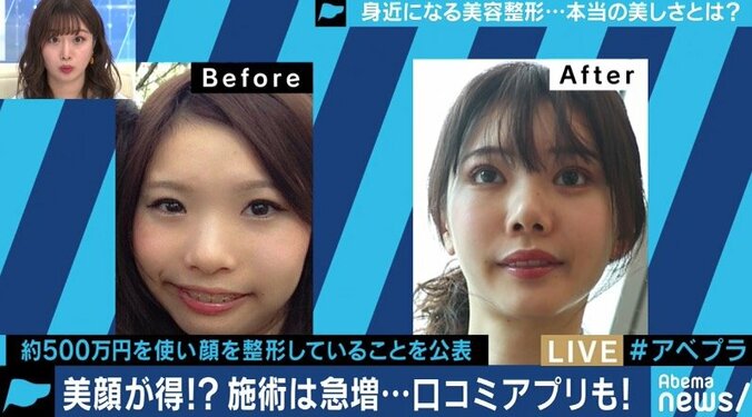 整形手術のイメージが変化、希望者が増加中？専門家「ゴールは美しい自分ではなく、明るい自分」 8枚目