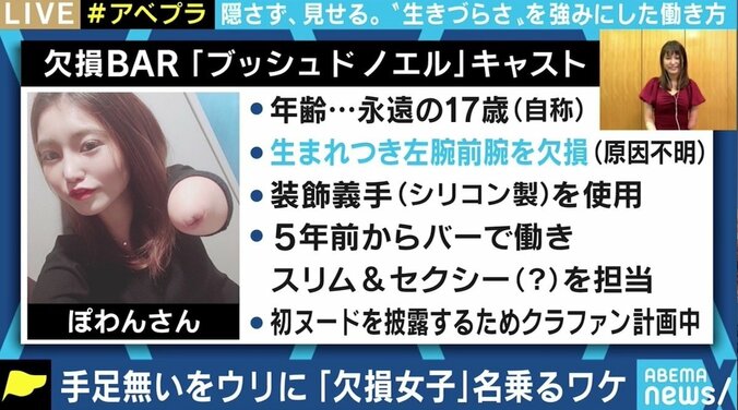 事故で右足ひざ下切断のこみみさん「何も提供してくれない第三者が『不謹慎』と言ってくる筋合いはないと思う」 障害を売りに働くことの是非 5枚目