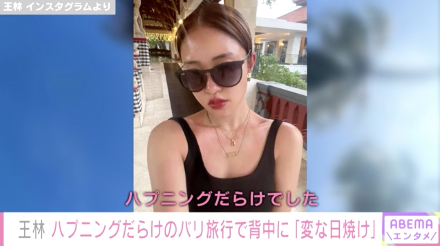 王林 変な日焼け をした背中を公開 ハプニングだらけのバリ旅行を振り返る Abema Times Goo ニュース