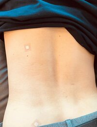 薬丸裕英『ブロック注射』