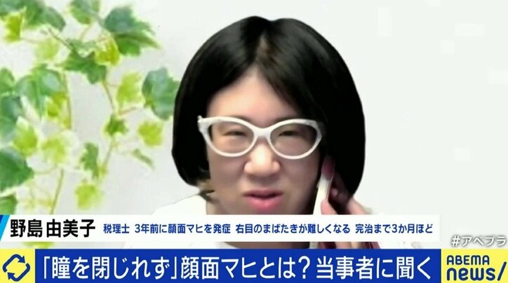 「自分の顔が自分の顔じゃなくなってしまう感じが残った」ジャスティン・ビーバーも罹患した“ラムゼイ・ハント症候群”、発症のピークは20代と50代に