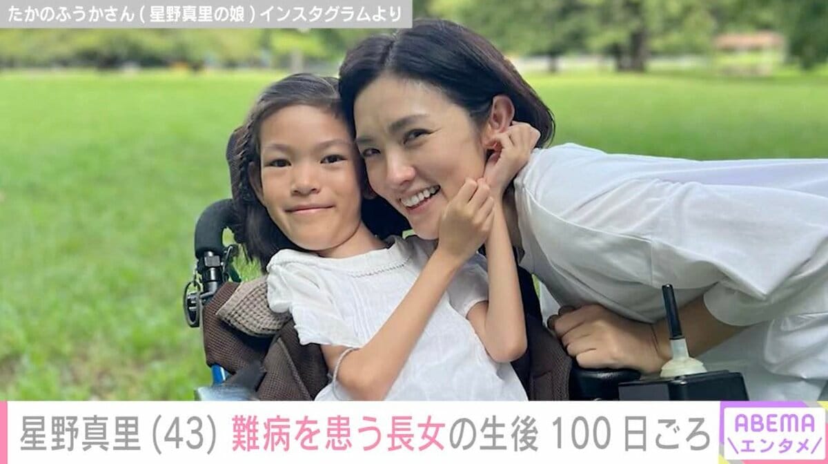 星野真里、指定難病「先天性ミオパチー」を患う9歳長女の生後100日ごろの写真公開「個人差があるからという言葉にすがっていた時期」 | エンタメ総合 |  ABEMA TIMES | アベマタイムズ