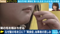 自分の髪の毛を食べてしまう女性に聞く“異食症”の実態