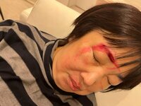 アレクサンダー『大変です‼️ おばあちゃん血だらけ‼️』