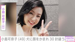 小島可奈子（49）、犬に顔をかまれ約30針縫ったことを明かす 「痛々しい」「傷が残りませんように」など心配の声