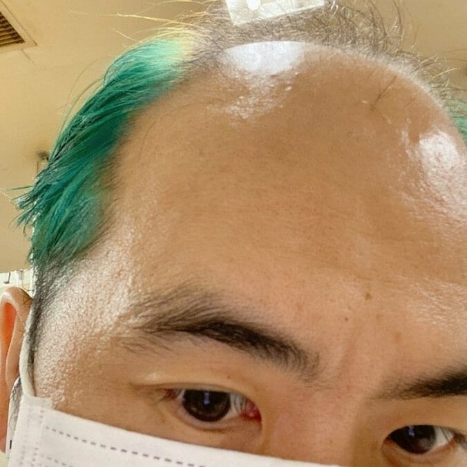トレエン斎藤、緑色にチェンジした髪を公開「青にしたかったのに」 1枚目