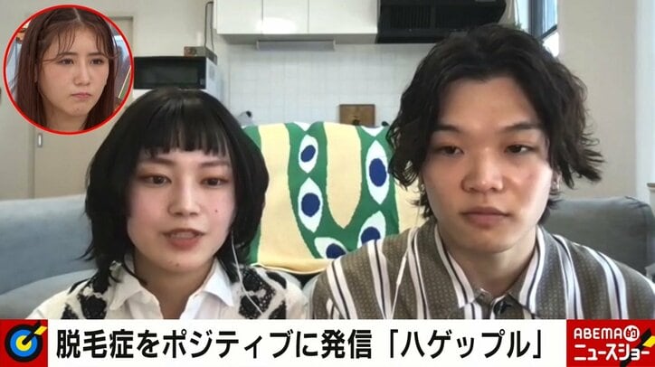 高校2年で髪が抜け落ちた女性 包み隠さず“脱毛症生活”を発信 彼女を前向きにした恋人の言葉